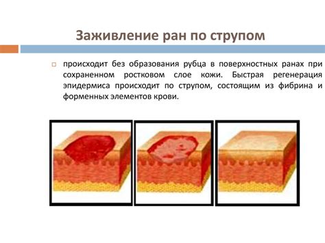 Влияние левомеколя на заживление раны