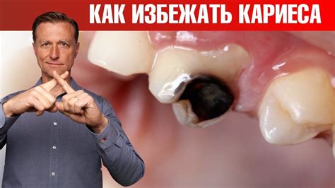 Как распознать уилбура