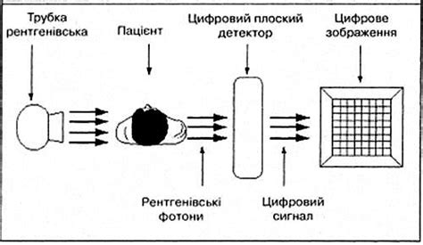 Процесс рентгеновского исследования