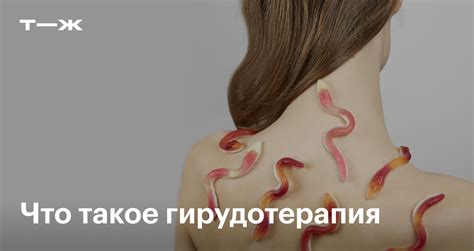 Рекомендации для применения пиявок на лимфоузлы: врачебный совет