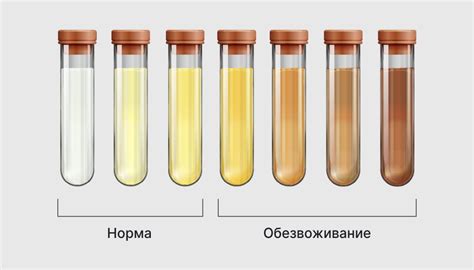 Изменения в цвете и прозрачности мочи
