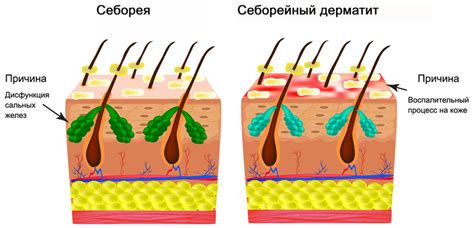 Физиологические причины полумесяца на голове