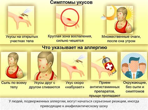 Аллергическая реакция на укус комара
