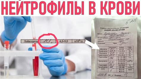 Возможные проблемы при понижении уровня полихроматофилов в крови