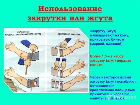 Использование жгута проволоки
