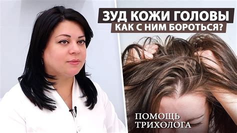 Йод в шампуне может вызвать перхоть и зуд