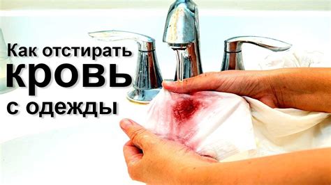КАК УДАЛЯТЬ ПЯТНА КРОВИ С ДУБЛЕНКИ В ДОМАШНИХ УСЛОВИЯХ