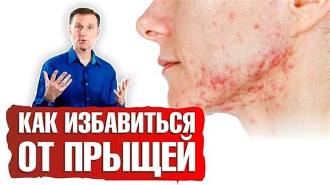 Как лечить прыщи с желтой жидкостью