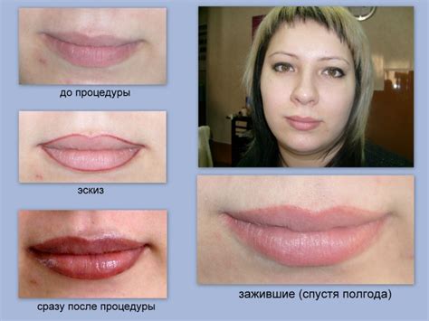 Как осветлить татуаж губ в домашних условиях