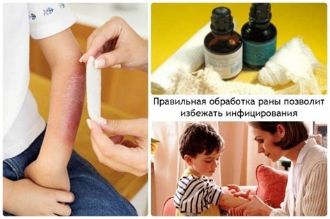 Как правильно обработать рану от вороны