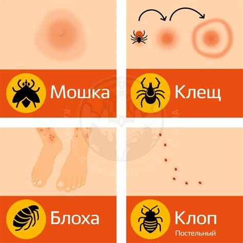 Как снять укус мошки с лица