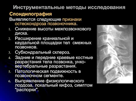 Методы измерения высоты тел позвонков