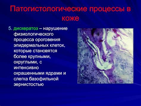 Нарушения физиологического процесса