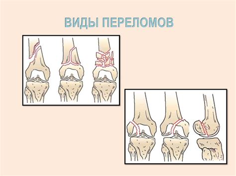 Наследственные повреждения костей и суставов