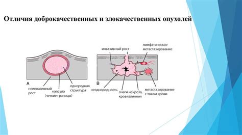 Опухоль или новообразование