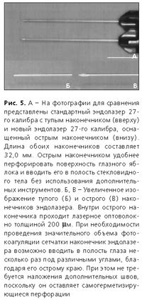 Перекройка и добавление дополнительных швов для увеличения объема