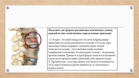 Повреждение позвоночника