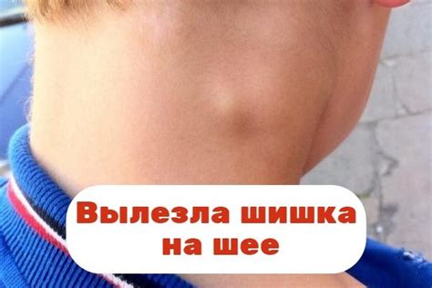 Причины возникновения шишки на шее кролика