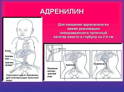 Причины появления правой персистирующей пупочной вены плода
