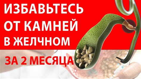Удаление нежелательных операций из истории