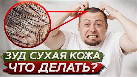 Ожоги кожи головы