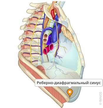 Правый синус облитерирован