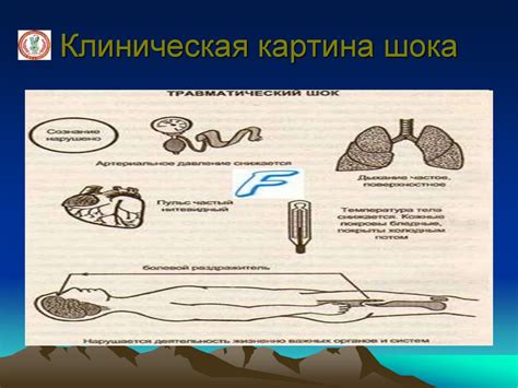 Причины появления ложбинки