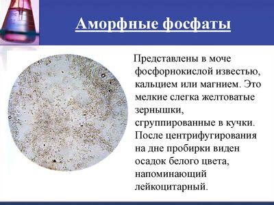 Причины появления Acinetobacter johnsonii в моче