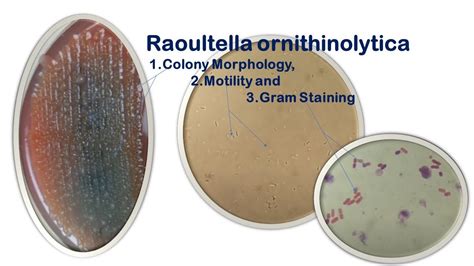 Сравнение Raoultella ornithinolytica с другими бактериями
